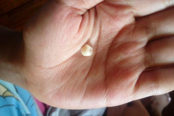 Article : La fée des dents malgache